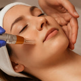 Microdermabrasión