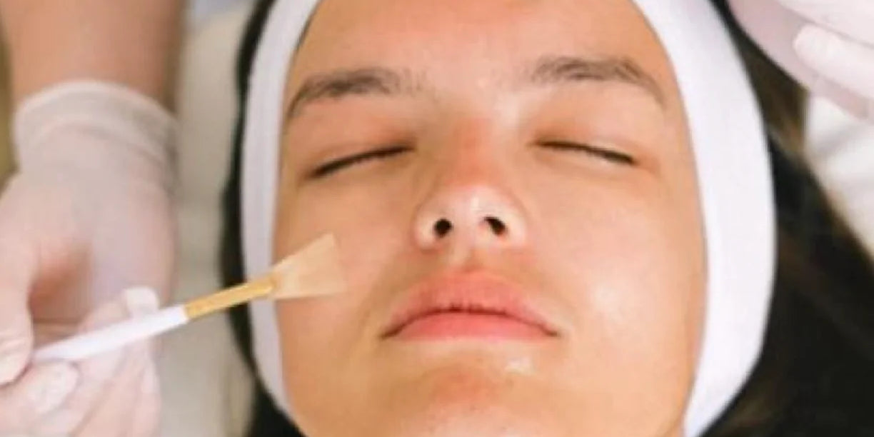 ¿Por qué una limpieza facial? y 5 puntos importantes